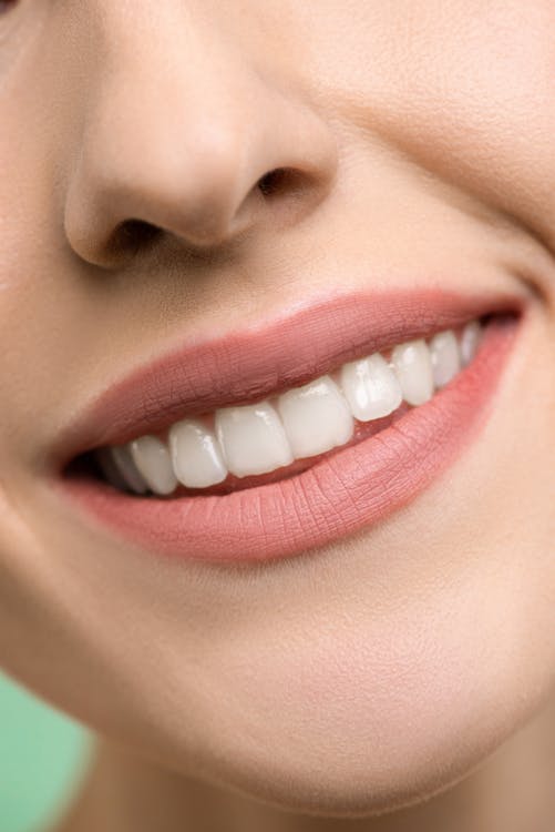 Woman Smiling with Healthy White Teeth